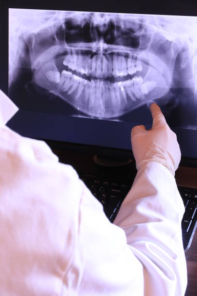 Best Emergency Root Canal Treatment in New Berlinville, PA