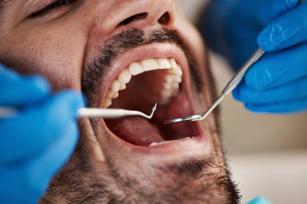 Best Emergency Dental Care for Trauma or Injury in New Berlinville, PA