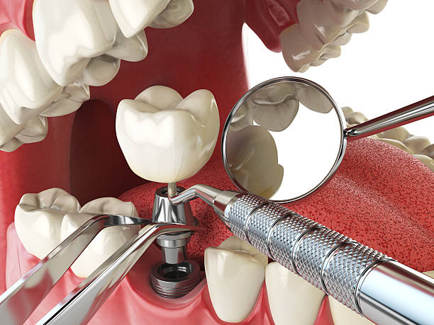 Best Emergency Treatment for Toothache in New Berlinville, PA