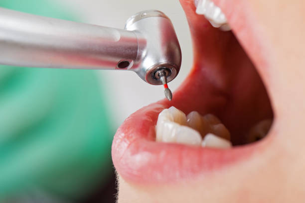 Best Emergency Tooth Extraction in New Berlinville, PA